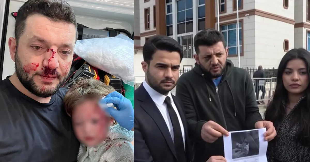 Yalova’da baba ile 14 aylık kızının darbedilmesi. Bebeğe vurduğunu kabul etti!