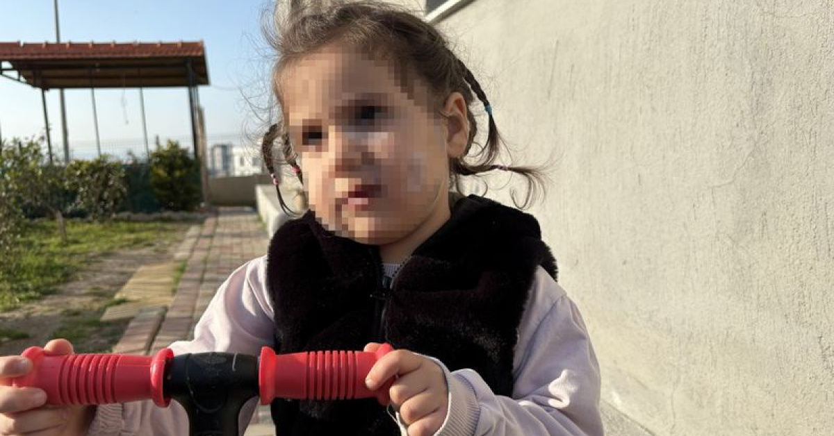 3 yaşındaki çocuk köpek saldırısına uğradı