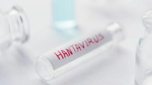 Hantavirüs nedir, nasıl bulaşır? Belirtileri neler, tedavisi var mı?