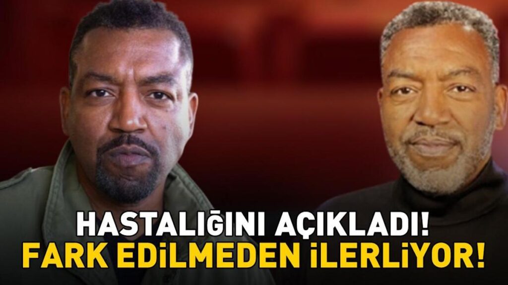 Grey’s Anatomy’nin Yıldızı Russell Andrews Hastalığını Açıkladı! Bu Belirtilere Dikkat! Fark Edilmeden İlerliyor!
