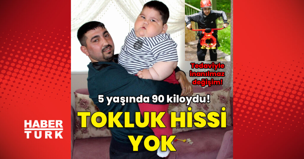 Tokluk hissi yok! 5 yaşında 90 kiloydu
